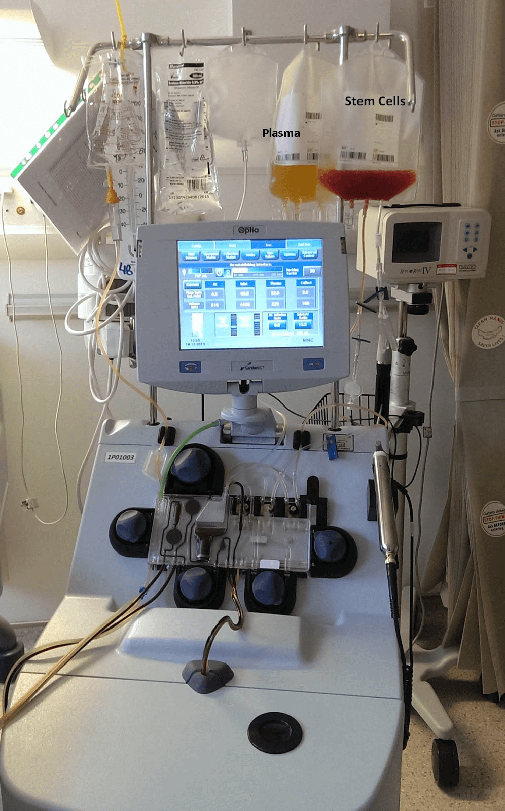 Optia machine with plasma and stem cell bags for apheresis.