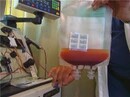 Gloved hand holding blood-filled medical bag beside equipment.